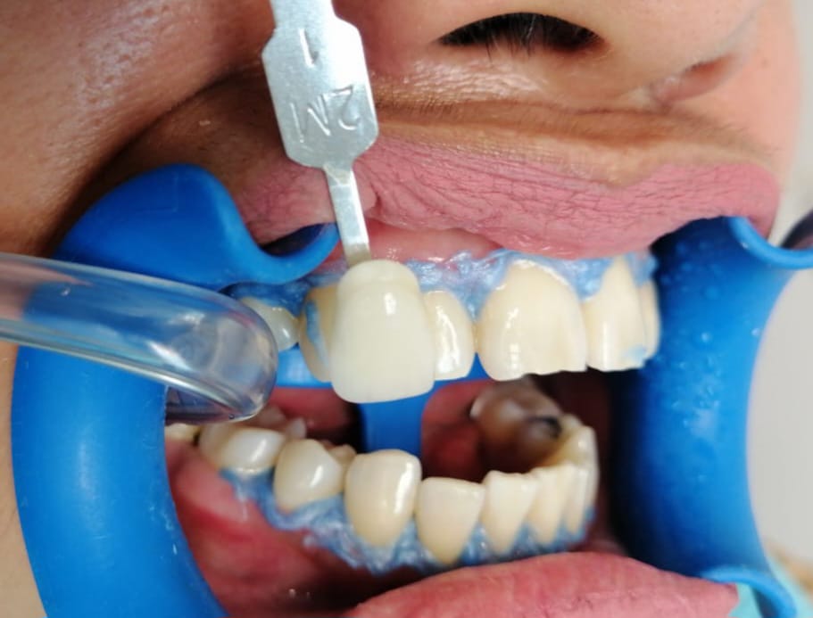 Productos dentales